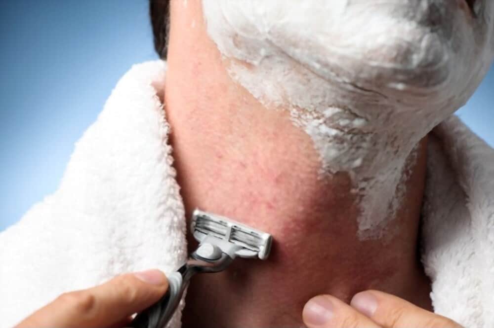 man has razor burn after shaving
