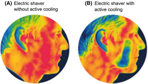 Effect of cooling technology on reducing irritation and itching